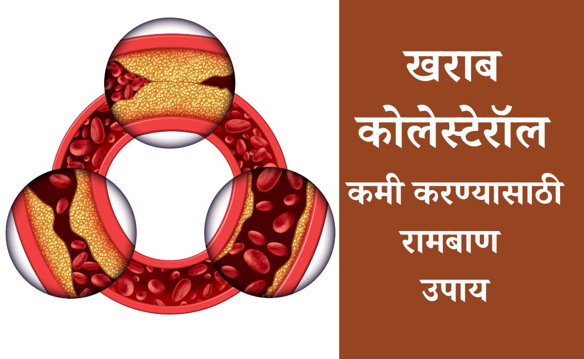 Bad Cholesterol Control Tips: दह्यात केवळ एक गोष्ट मिक्स करुन खा, खराब कोलेस्टेरॉल पटकन होईल कमी; वाचा उपाय