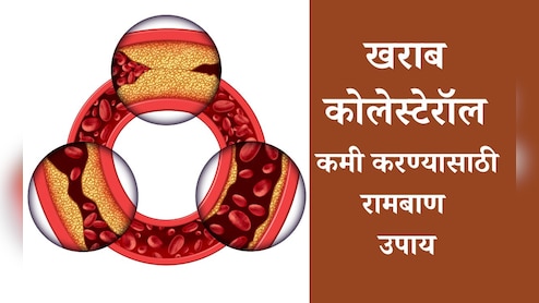 Bad Cholesterol Control Tips: दह्यात केवळ एक गोष्ट मिक्स करुन खा, खराब कोलेस्टेरॉल पटकन होईल कमी; वाचा उपाय