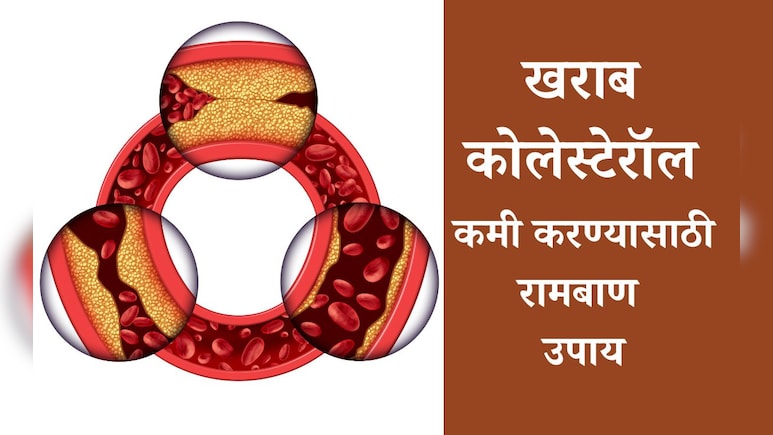 Bad Cholesterol Control Tips: दह्यात केवळ एक गोष्ट मिक्स करुन खा, खराब कोलेस्टेरॉल पटकन होईल कमी; वाचा उपाय Bad Cholesterol Control Tips: दह्यात केवळ एक गोष्ट मिक्स करुन खा, खराब कोलेस्टेरॉल पटकन होईल कमी; वाचा उपाय