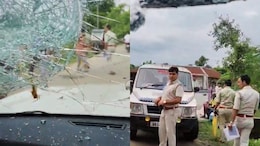 BJP MP Attacked During Jalpaiguri Visit Likely To Undergo Facial Surgeries