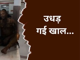 पारिवारिक विवाद में आत्मदाह का प्रयास, हालत गंभीर, भाई बोला- भाभी और दामाद ने पेट्रोल डालकर जलाया