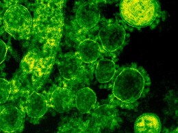 तो क्‍या गलत थी सुपरबग पर लैंसेट रिपोर्ट! NCDC ने क्‍यों कहा भारत में नहीं बढ़ा सुपरबग संक्रमण का खतरा