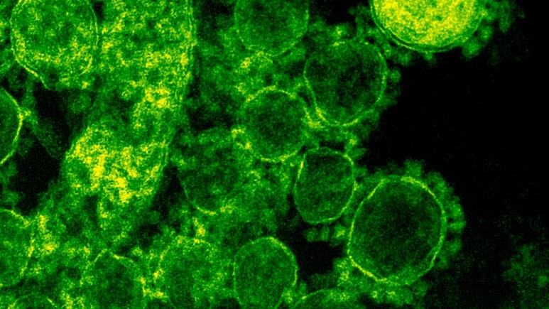 तो क्‍या गलत थी सुपरबग पर लैंसेट रिपोर्ट! NCDC ने क्‍यों कहा भारत में नहीं बढ़ा सुपरबग संक्रमण का खतरा