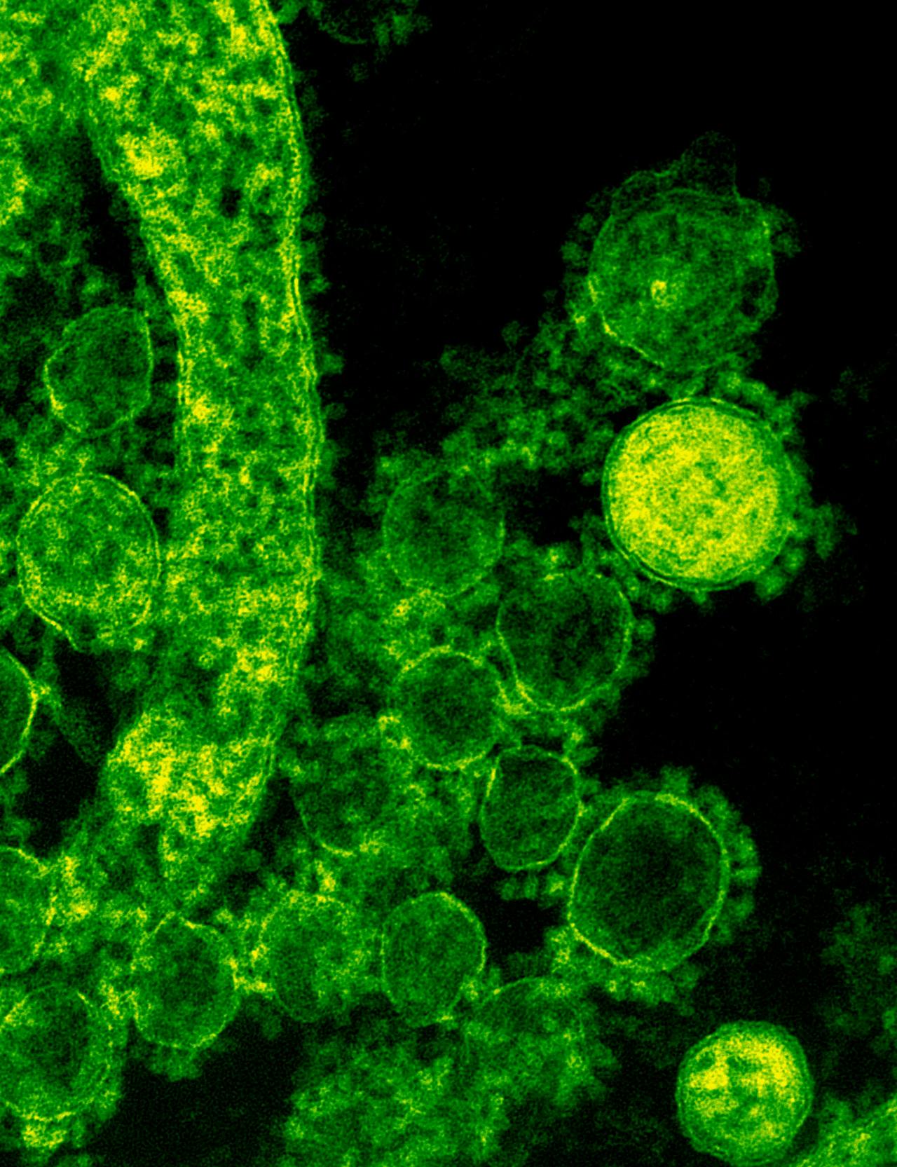 What Are Superbugs? The Bacteria Behind India's Antibiotic Resistance Crisis, Explained