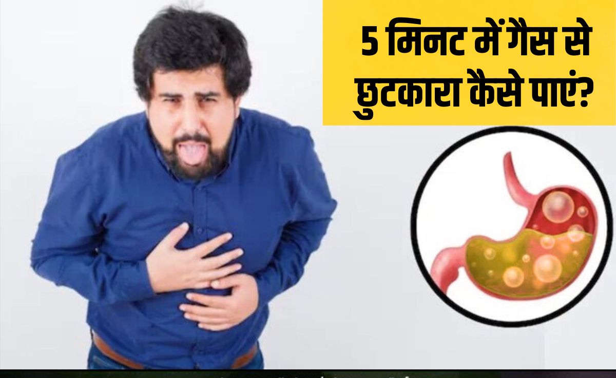पेट में गैस होने पर कौन सा पॉइंट दबाना चाहिए? पेट की गैस तुरंत कैसे निकाले, यह करने से म‍िलेगी राहत
