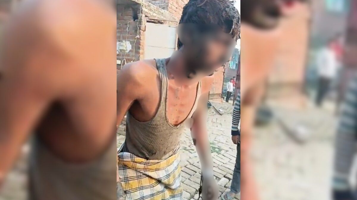 Man Tied To Pole, Set On Fire After Dispute Over Prayers In UP Mosque