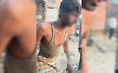 Man Tied To Pole, Set On Fire After Dispute Over Prayers In UP Mosque