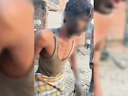 Man Tied To Pole, Set On Fire After Dispute Over Prayers In UP Mosque