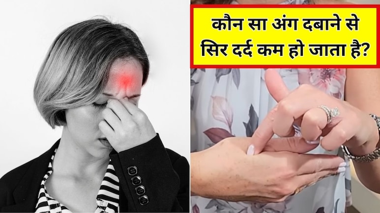 सिर में दर्द हो तो कौन सा पॉइंट दबाना चाहिए? डॉक्टर ने बताया सिर दर्द का एक्यूप्रेशर पॉइंट कहां होता है