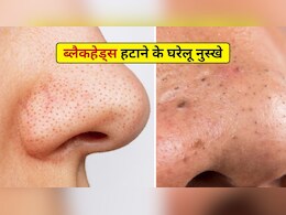 नाक पर जमे जिद्दी ब्लैकहेड्स कर रहे हैं खूबसूरती फीकी? आजमाएं ये आसान घरेलू नुस्खे, मिनटों में दूर हो जाएगी समस्या