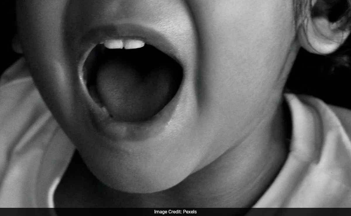 11-Year-Old In China Accidentally Swallows Gold Bean Worth 1,400 Dollars