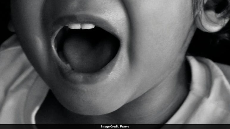 11-Year-Old In China Accidentally Swallows Gold Bean Worth 1,400 Dollars 11-Year-Old In China Accidentally Swallows Gold Bean Worth 1,400 Dollars