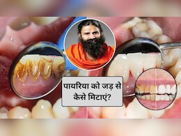 Teeth Care Tips: दांत दर्द और पायरिया का रामबाण इलाज है ये पौधा, बाबा रामदेव ने बताया कैसे करें इस्तेमाल
