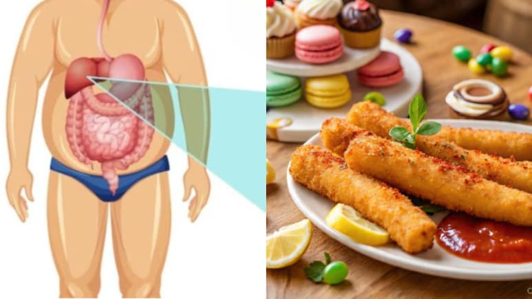 फैटी लिवर से बचाव का आसान तरीका: जानिए क्या खाएं और क्या न खाएं