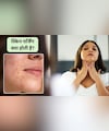 चेहरे पर बार-बार फुंसी और दाने निकल रहे हैं? त्वचा खराब होने का संकेत या क्लियर स्किन शुरुआत?