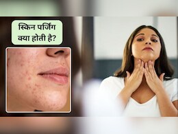 What is Skin Purging: चेहरे पर बार-बार फुंसी और दाने निकल रहे हैं? त्वचा खराब होने का संकेत या क्लियर स्किन शुरुआत? जानिए स्किन पर्जिंग क्या है
