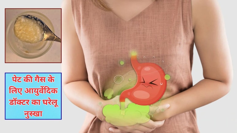 गैस से छुटकारा पाने के लिए खाना खाने से पहले अपनाएं ये घरेलू नुस्खा, डॉक्टर ने बताया पहली बार में ही दिख जाएगा असर