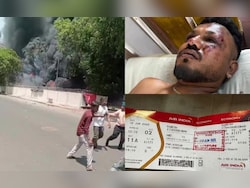&quot;Everyday Is Painful&quot;: Lone Air India Crash Survivor After Miracle Escape