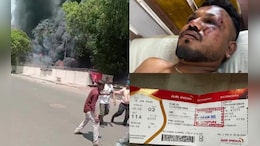 "Every Day Is Painful": Lone Air India Crash Survivor After Miracle Escape