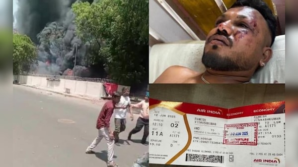 'Every Day Is Painful': Lone Air India Crash Survivor After Miracle Escape