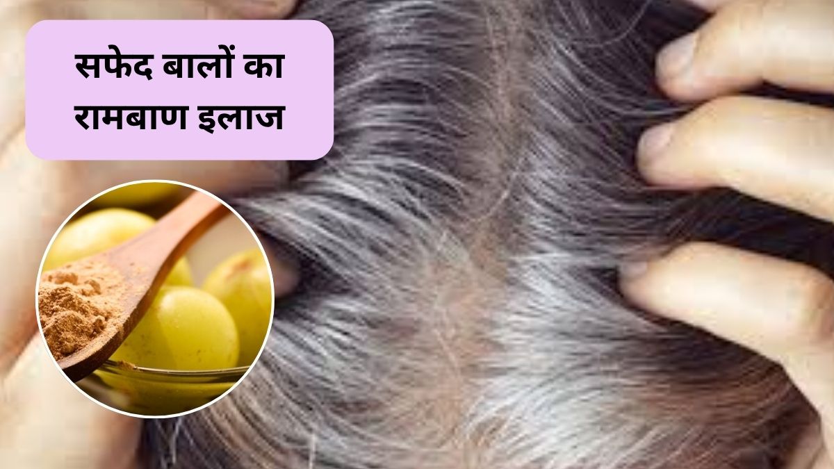 Amla Powder For White Hair: आंवला पाउडर के साथ ये 2 चीजें मिलाकर सिर में लगाएं, सफेद बालों को कहें अलविदा