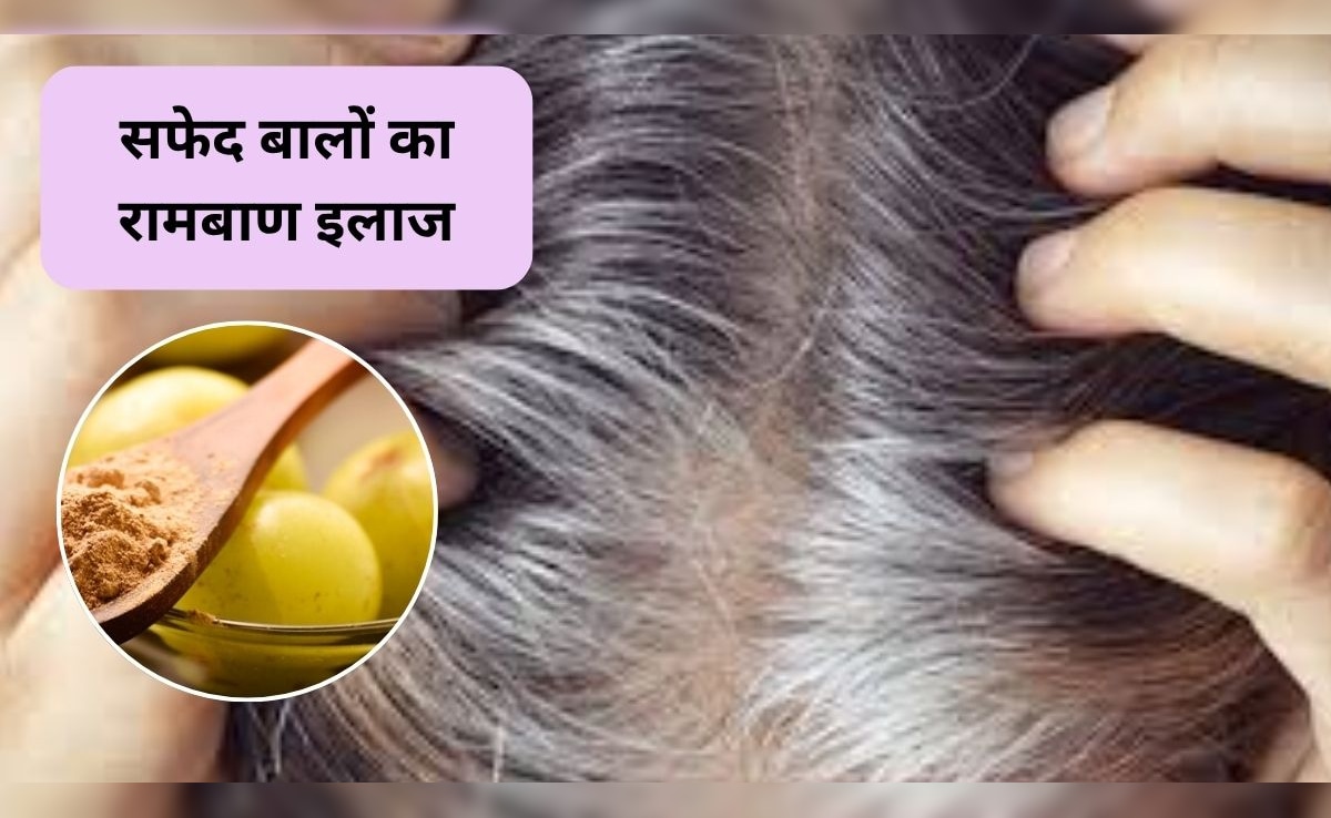 Amla Powder For White Hair: आंवला पाउडर के साथ ये 2 चीजें मिलाकर सिर में लगाएं, सफेद बालों को कहें अलविदा