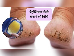 सर्दी में हाथ पैर-फट गए हैं तो पेट्रोलियम जेली घर पर कैसे बनाएं, 5 म‍िनट में हो जाएगी तैयार