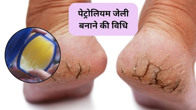 सर्दी में हाथ पैर-फट गए हैं तो पेट्रोलियम जेली घर पर कैसे बनाएं, 5 म‍िनट में हो जाएगी तैयार