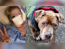 कुत्ते ने नोच ली नाक और निगल गया...करवानी पड़ गई 16 सर्जरी, फिर डॉक्टर्स बनाई दूसरी नाक!