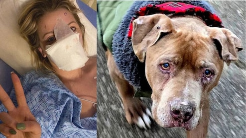 कुत्ते ने नोच ली नाक और निगल गया...करवानी पड़ गई 16 सर्जरी, फिर डॉक्टर्स बनाई दूसरी नाक!