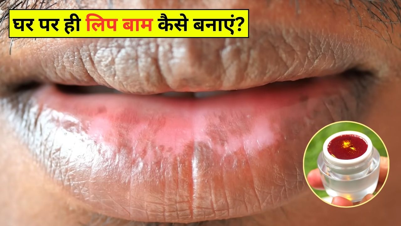 रूखे-फटे होठों ने कर दिया है परेशान? चुकंदर-एलोवेरा से बनाएं होममेड लिप बाम, हो जाएंगे गुलाबी और मुलायम