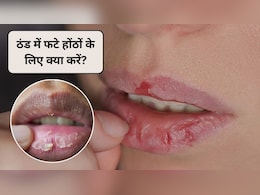 क्या आप ठंड के कारण फटे होंठों से परेशान हैं? रात में होंठों पर क्या लगाना चाहिए, डॉक्टर ने बताया 1 दिन में फटे होंठ ठीक करने का उपाय