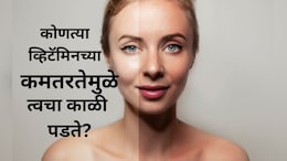 Glowing Face Tips: कोणत्या व्हिटॅमिनच्या कमतरतेमुळे चेहरा काळा पडू लागतो? काय खाल्ल्यास चेहऱ्यावर नॅचरल ग्लो येईल