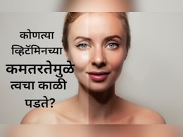 Glowing Face Tips: कोणत्या व्हिटॅमिनच्या कमतरतेमुळे चेहरा काळा पडू लागतो? काय खाल्ल्यास चेहऱ्यावर नॅचरल ग्लो येईल