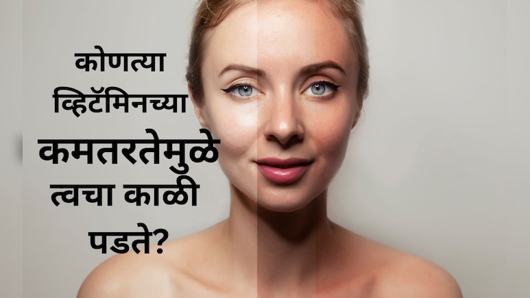 Glowing Face Tips: कोणत्या व्हिटॅमिनच्या कमतरतेमुळे चेहरा काळा पडू लागतो? काय केल्यास चेहऱ्यावर ग्लो येईल