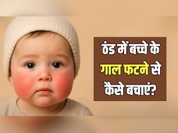 सर्दियों में बच्चे के गाल फटने से कैसे बचाएं? पीडियाट्रिशियन ने बताया कैसे रखें स्किन का ख्याल