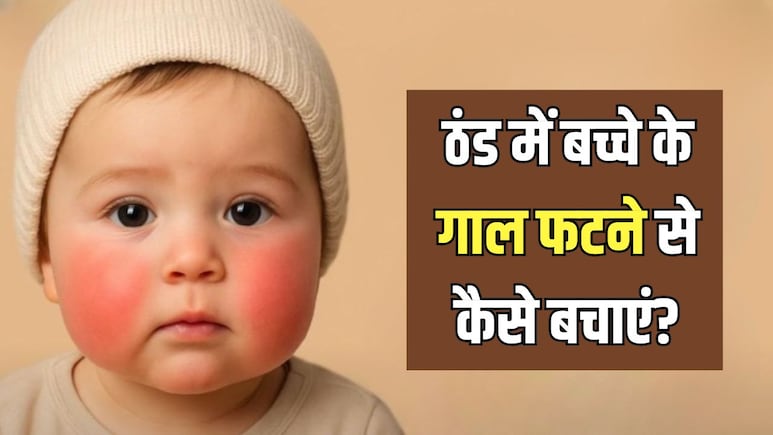 सर्दियों में बच्चे के गाल फटने से कैसे बचाएं? पीडियाट्रिशियन ने बताया कैसे रखें स्किन का ख्याल