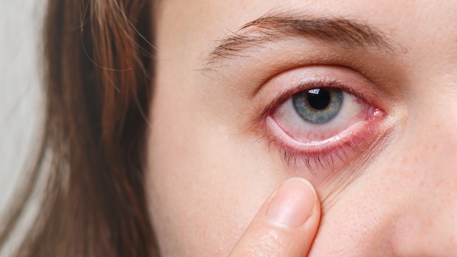Air pollution eye damage.