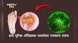 High Uric Acid: हाय युरिक अ&zwj;ॅसिड समस्येमुळे त्रस्त आहात? हे हिरवेगार पान ठरेल वरदान, उपचाराची योग्य पद्धत वाचा