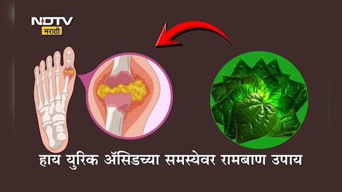 High Uric Acid: हाय युरिक अॅसिड समस्येमुळे त्रस्त आहात? हे हिरवेगार पान ठरेल वरदान, उपचाराची योग्य पद्धत वाचा High Uric Acid: हाय युरिक अॅसिड समस्येमुळे त्रस्त आहात? हे हिरवेगार पान ठरेल वरदान, उपचाराची योग्य पद्धत वाचा