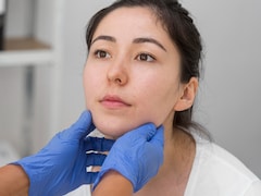 What Is A Facelift? All You Need To Know About The Popular Plastic Surgery