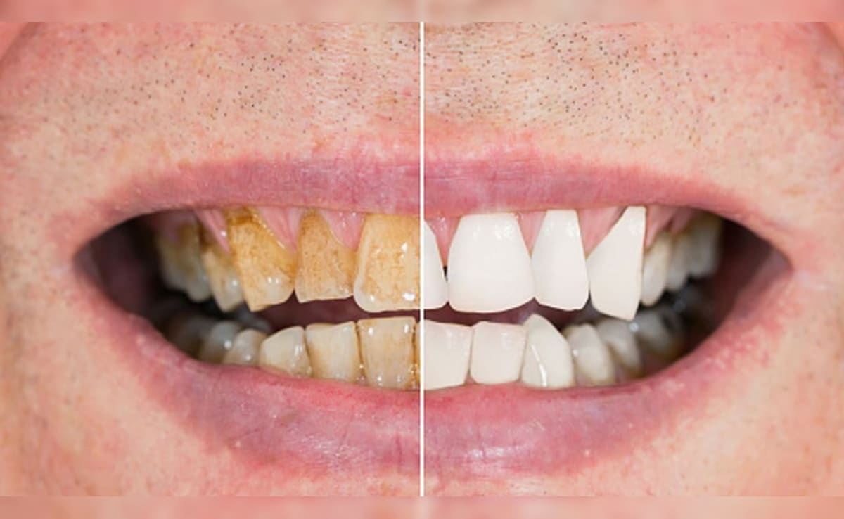 Latest and Breaking News on NDTV Latest and Breaking News on NDTV