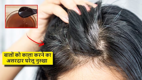 तिल के तेल के साथ मिला लें फ्रिज में रखी ये चीज, काले होने लगेंगे सफेद बाल, डॉक्टर ने बताया कमाल का घरेलू नुस्खा