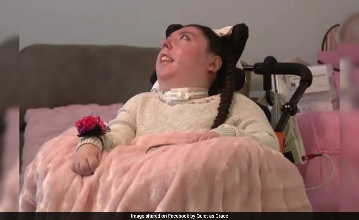 US Woman Born With No Brain Celebrates 20th Birthday, Doctors Said She Wouldn't Live Past 4