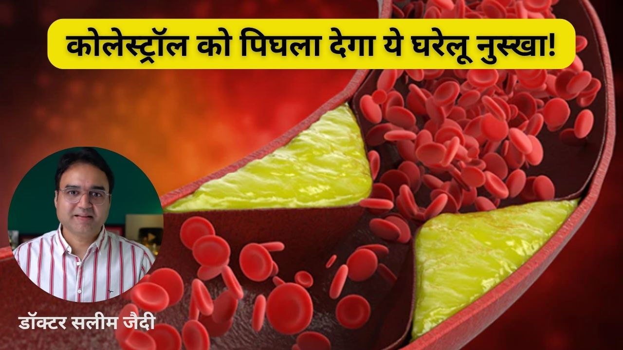 कोलेस्ट्रॉल को बिना दवा के कैसे कंट्रोल करें? डॉ. सलीम जैदी ने बताया आसान आयुर्वेदिक नुस्खा