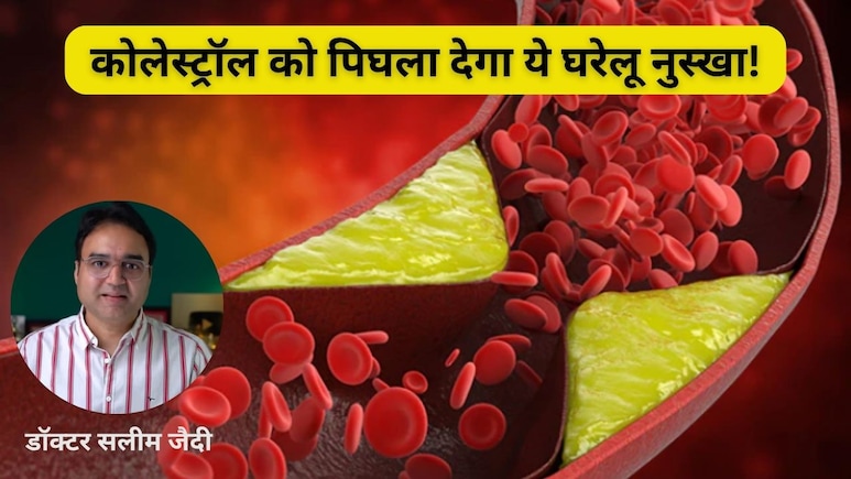 कोलेस्ट्रॉल को बिना दवा के कैसे कंट्रोल करें? डॉ. सलीम जैदी ने बताया आसान आयुर्वेदिक नुस्खा