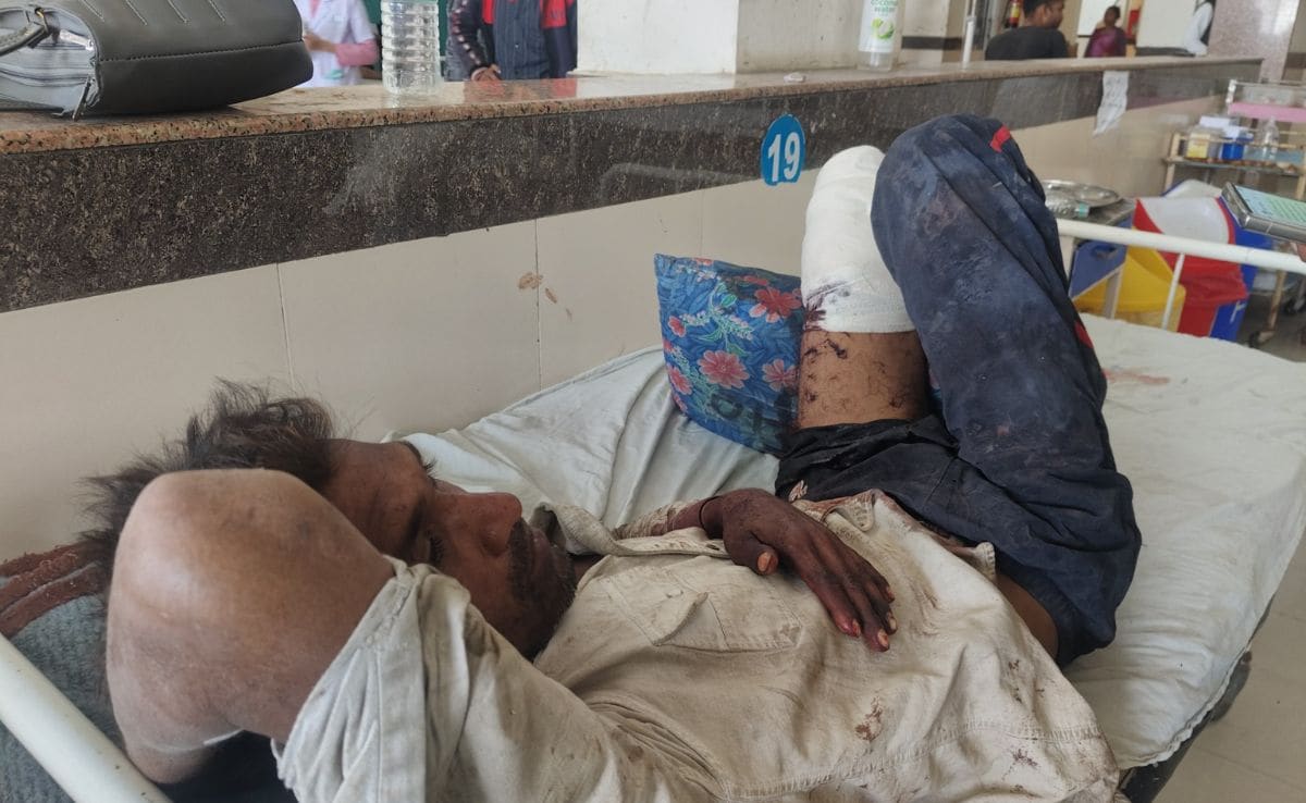 Man Robbed, Loses Leg. Cops Take Him To Hospital, Leave Limb Behind