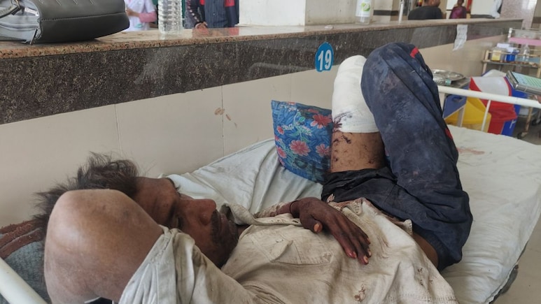 Man Robbed, Loses Leg. Cops Take Him To Hospital, Leave Limb Behind