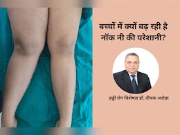 बच्चों में क्यों बढ़ रही 'नॉक नी' की समस्या, Orthopedic Surgeon से जानिए  लक्षण, कारण और इलाज