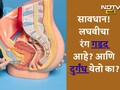 Urinary Tract Infection Causes: लघवी करताना जळजळ होते, वारंवार पण थोडीच लघवी होते?  वाचा उपाय आयुर्वेदिक उपाय